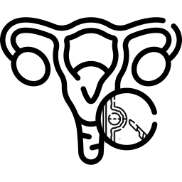 Robotic Ovarian Cyst Removal in mohali